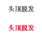 头顶脱发