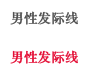 男性发际线