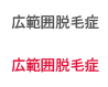 광범위탈모