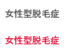여성형탈모
