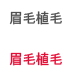 눈썹이식