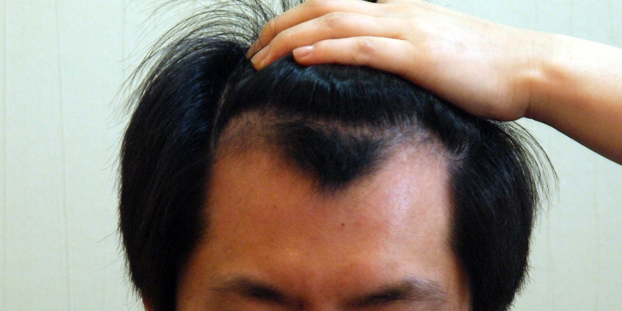 후사진