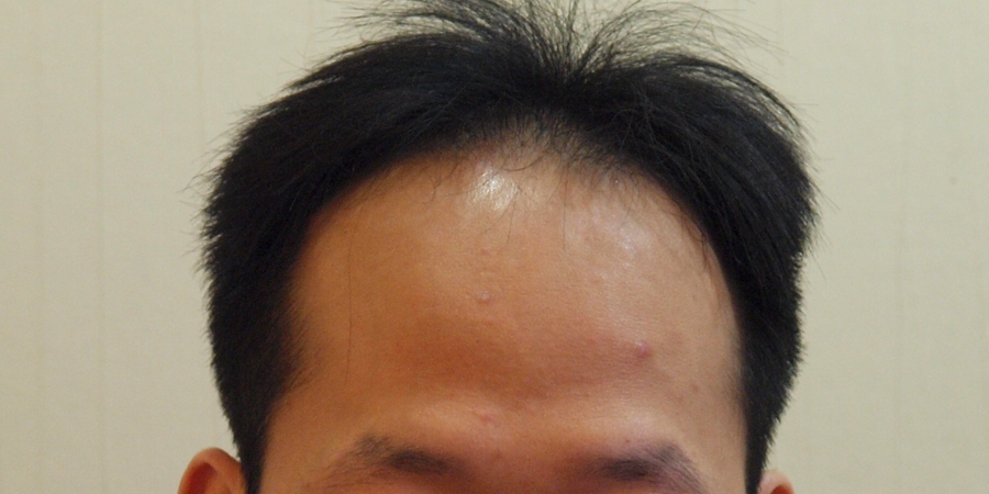 후사진