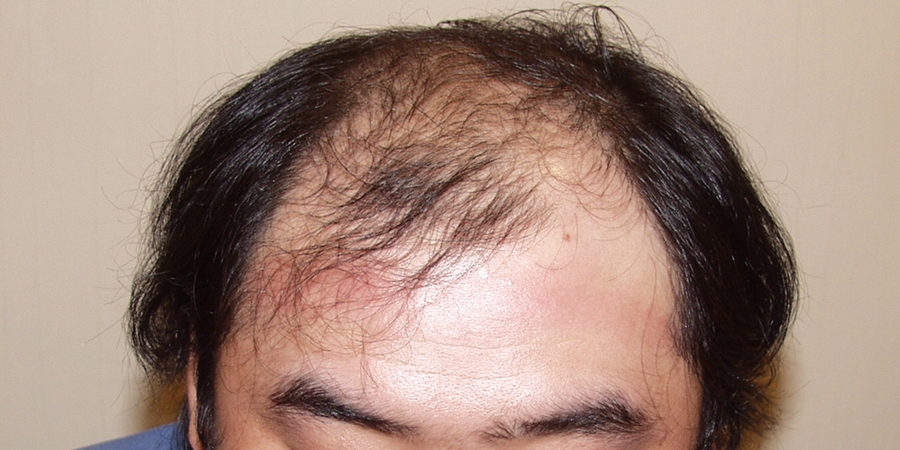 후사진