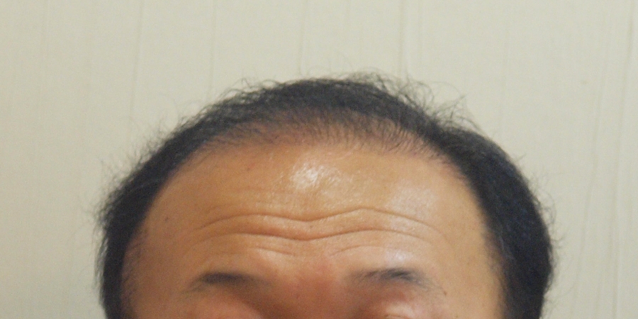 후사진
