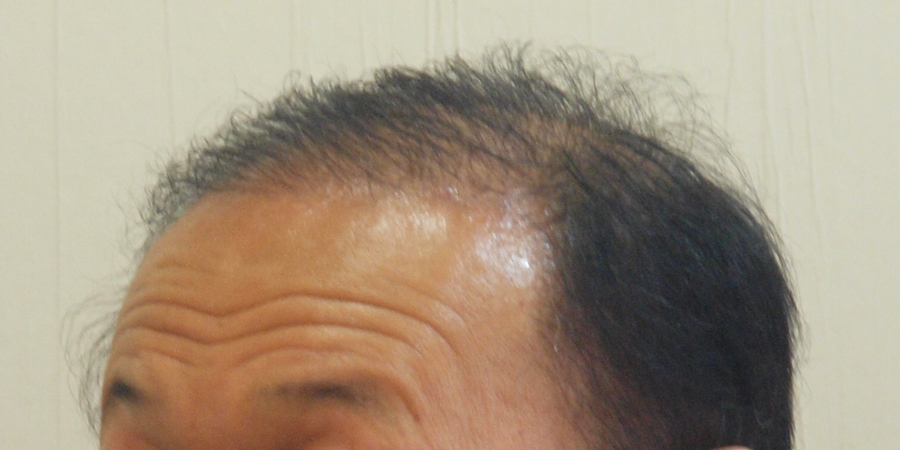 후사진