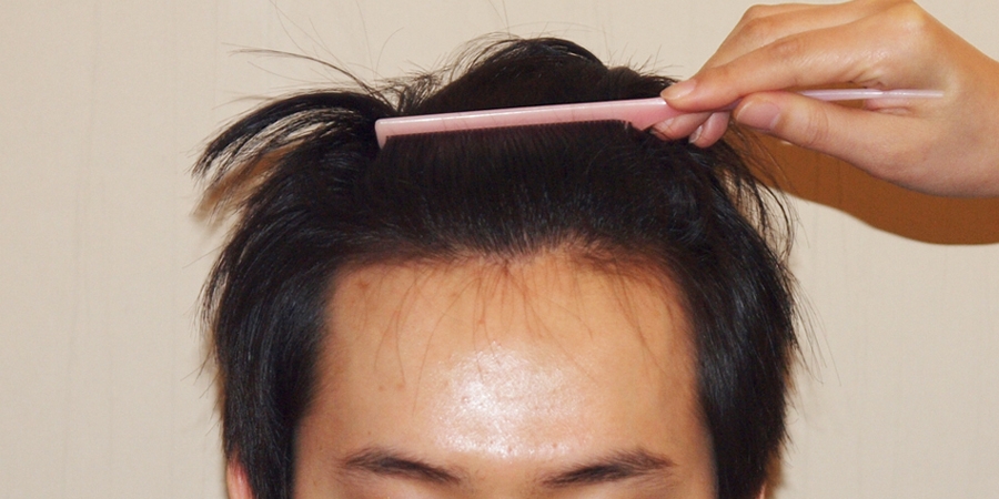 후사진