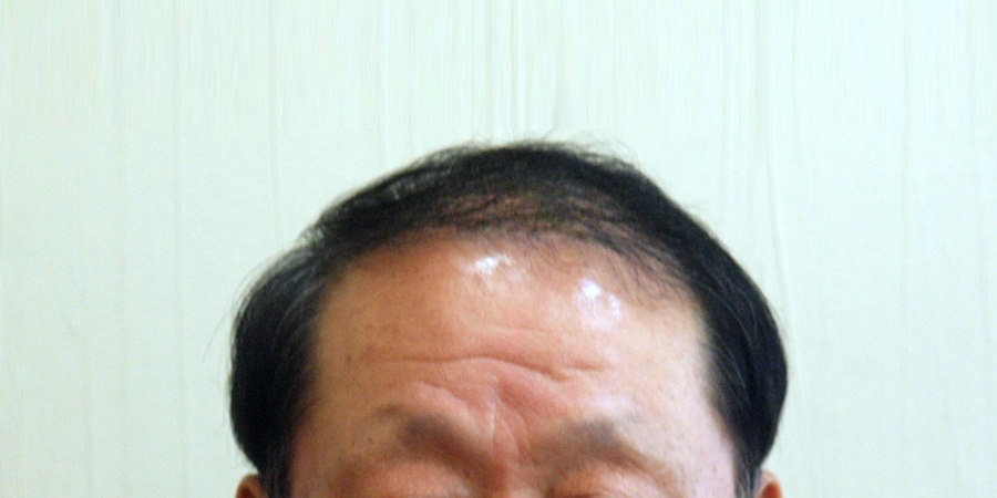 후사진