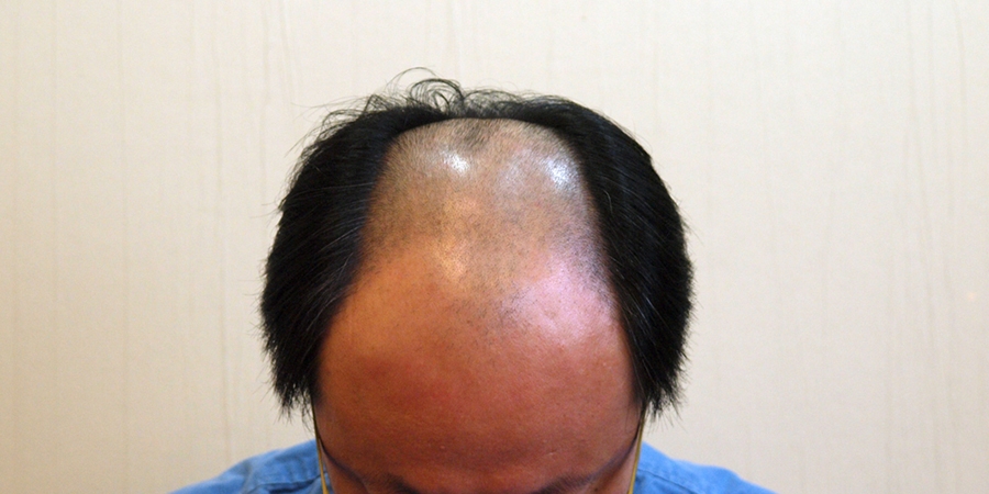 후사진