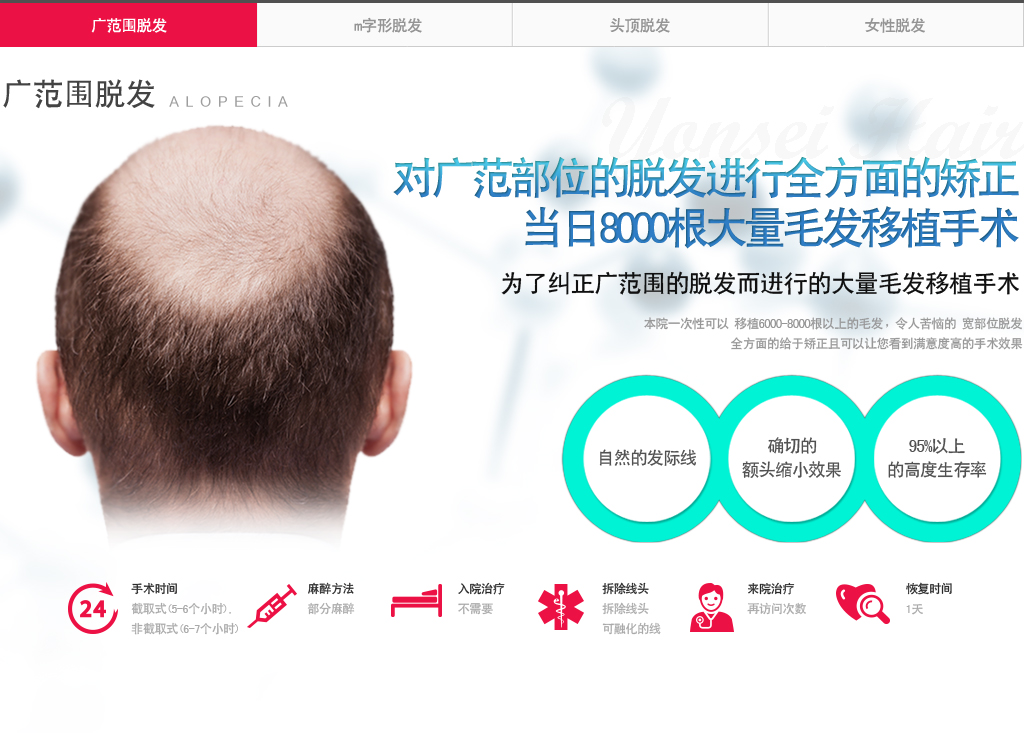 广范围脱发