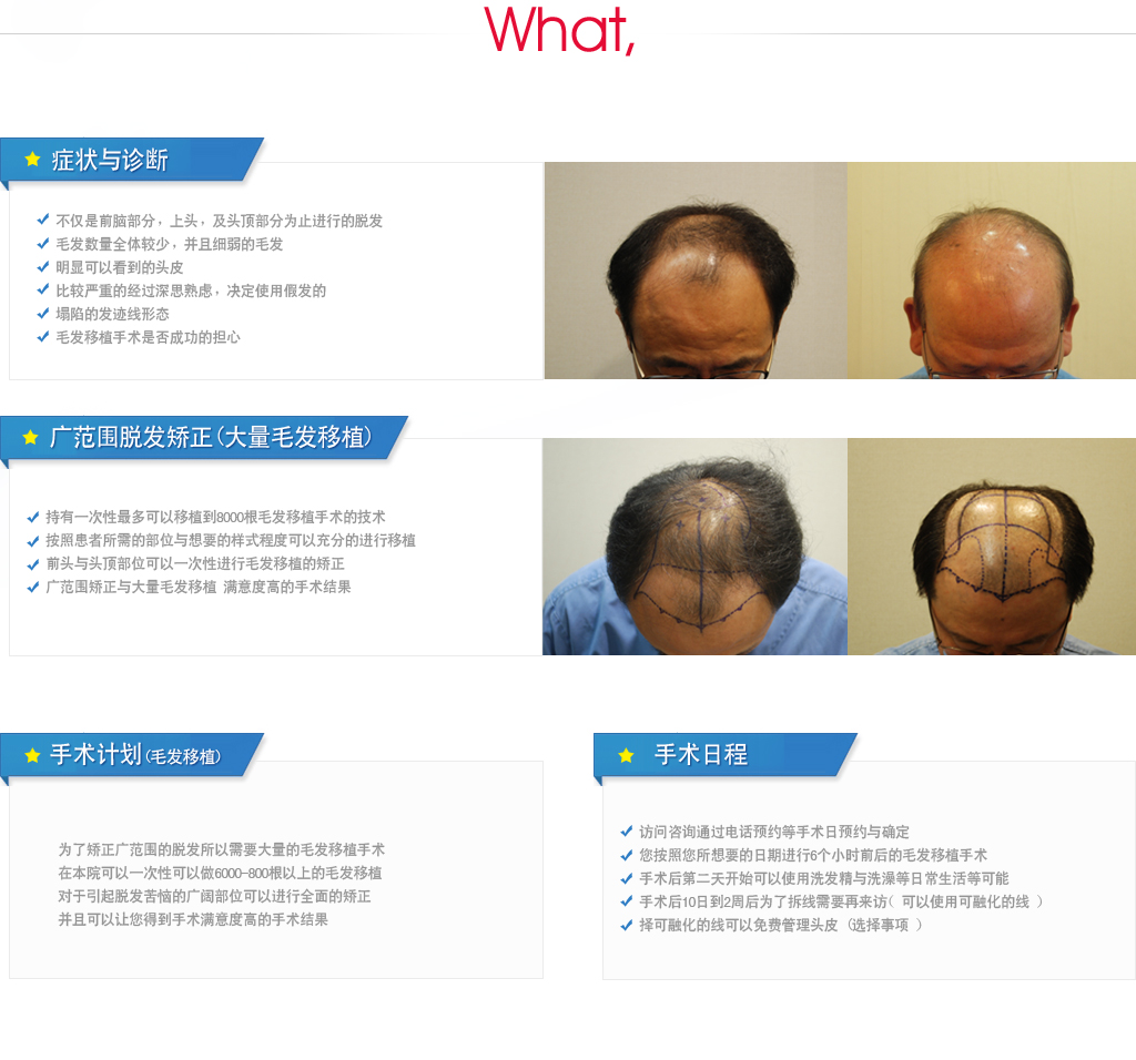 广范围脱发