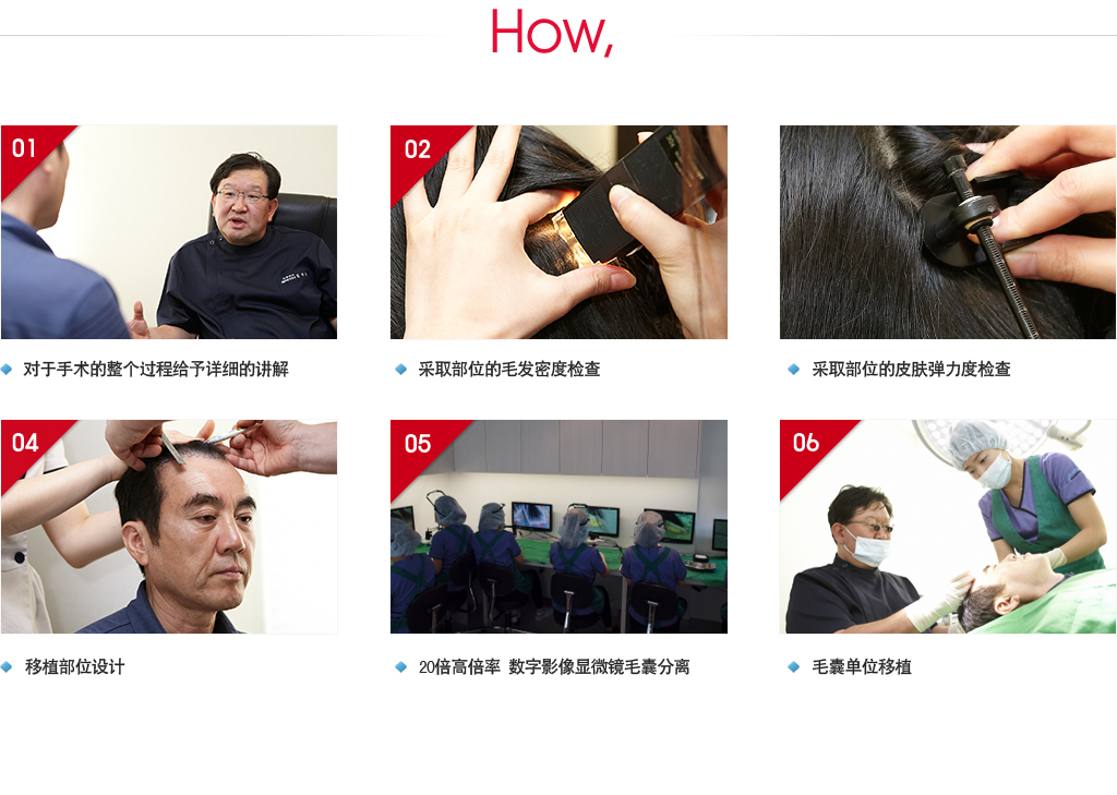 女性脱发