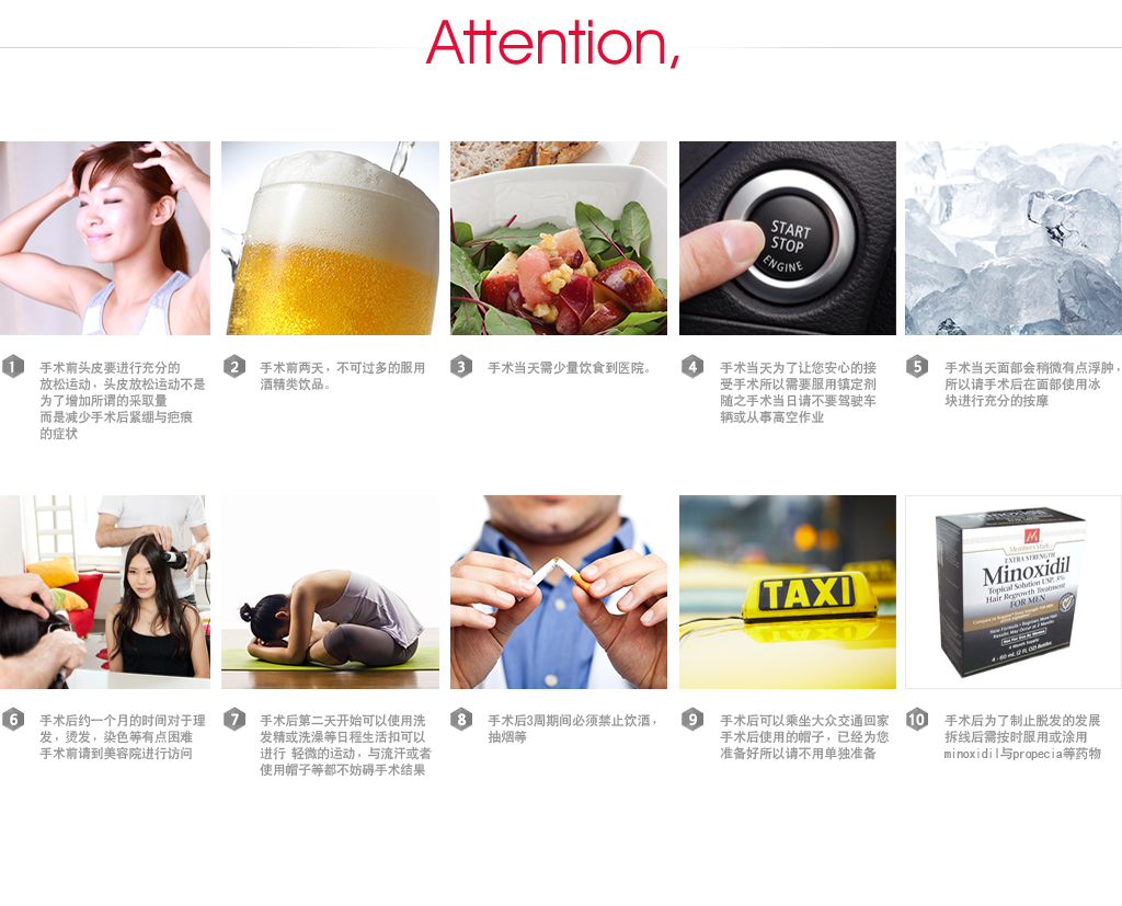 女性脱发