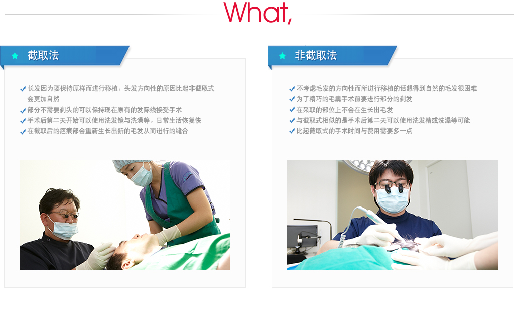 女性脱发
