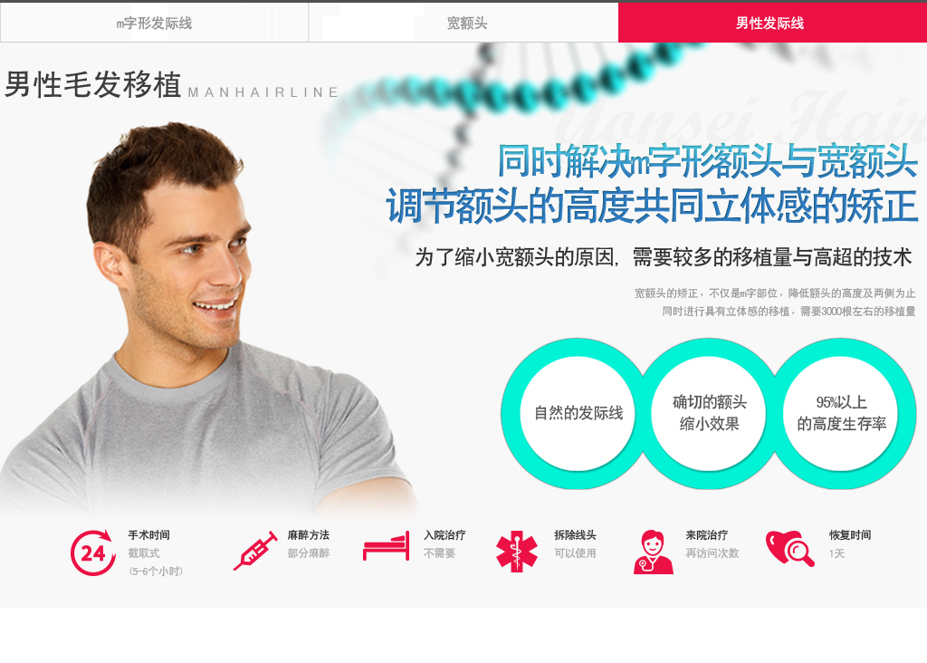 男性发际线