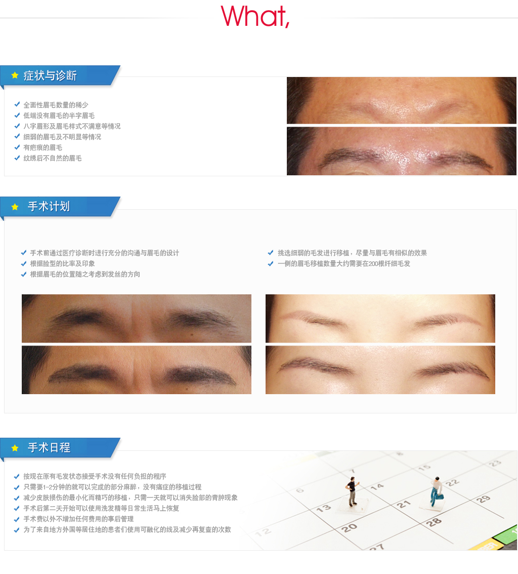 眉毛移植